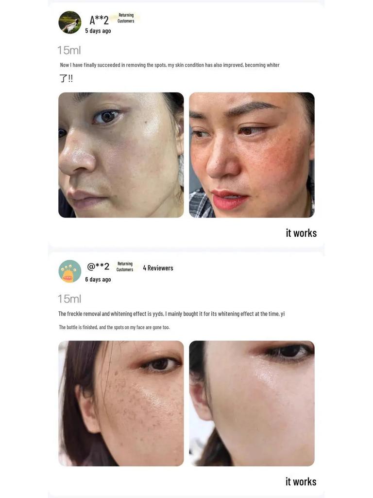 Han Bei Dan White Oil - Whitening & Freckle Removal Essence