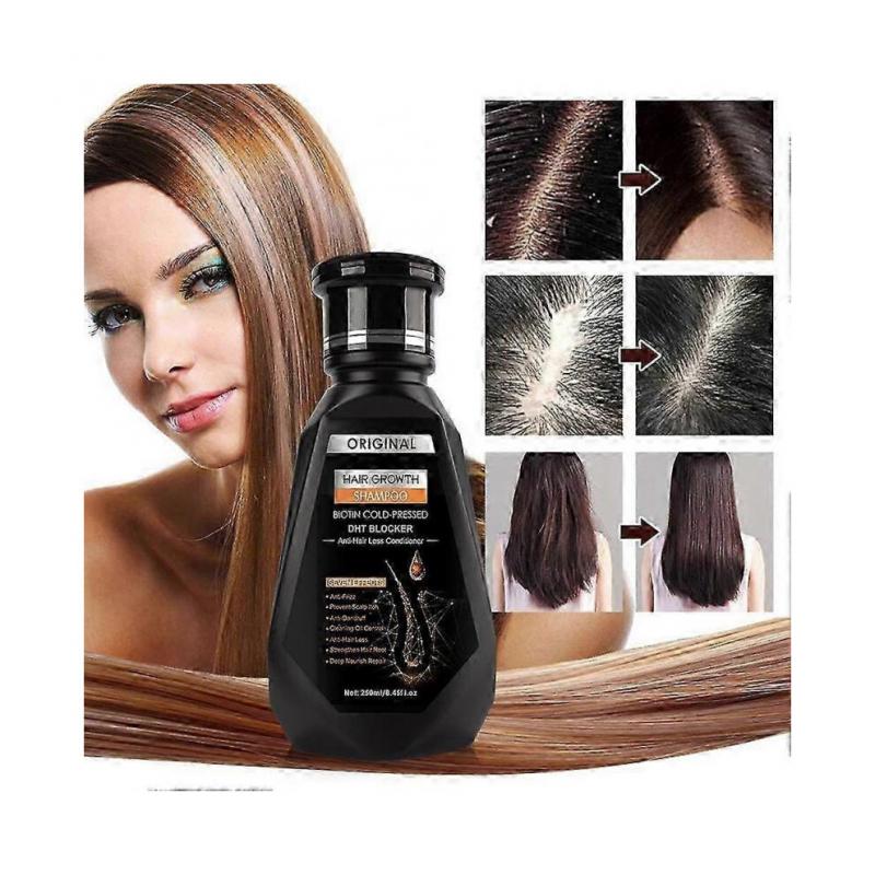 Ginger Shampoo Hair Treatments Hair Growth Hair Care Anti-hair Loss Hair