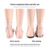 TPU Arch Support Insoles for Knock Knees & Flat Feet, Foot Eversion Correction Pads