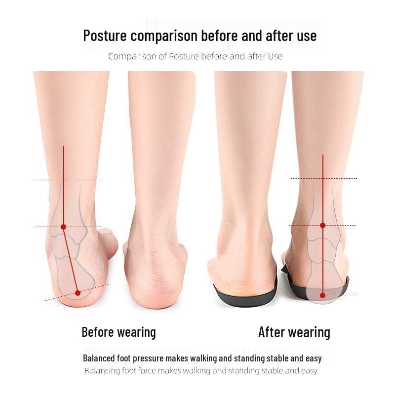 TPU Arch Support Insoles for Knock Knees & Flat Feet, Foot Eversion Correction Pads