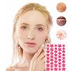200/400PCS Colorful Combination Acne Patches Star Heart Type Pimple Sticker PE Facial Concealer Acne Marks Cover Patches