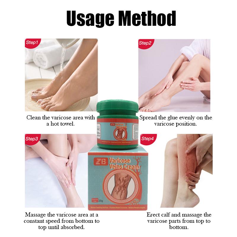 ZB Varicose Veins Relief CreamVasculitis Phlebitis Spider Pain ReliefOintment Medical Plaster Body Care 20g