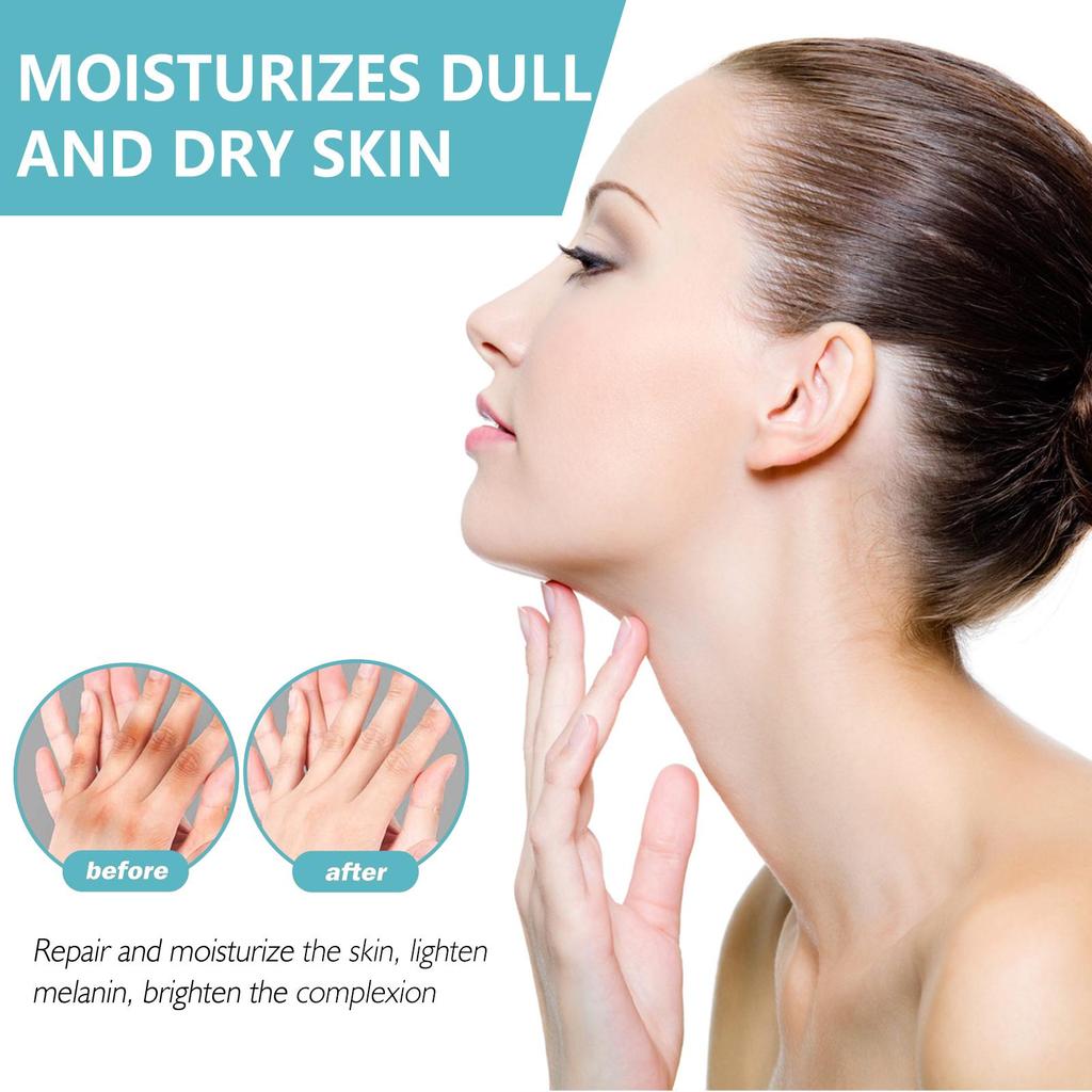 Spot Remover For Body,Spot Corrector Cream,- Underarm, Neck, Armpit, Knees, Elbows, Private Areas, Intimate Areas