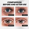 Temporary Eye Bags Removal Cream Instant Under Eye Firming And Tightening Eye Cream Lifts And Firms Eye Skin For Dark Circles