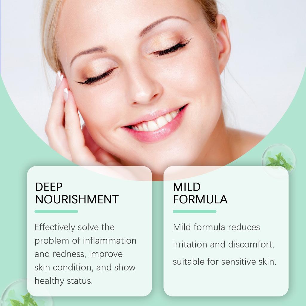 2PCS Acne-clearing Cream, Oil-control, Hydrating, Moisturizing, Balancing Skin, Refining Pores, Acne-clearing, Moisturizing Skin Care Cream