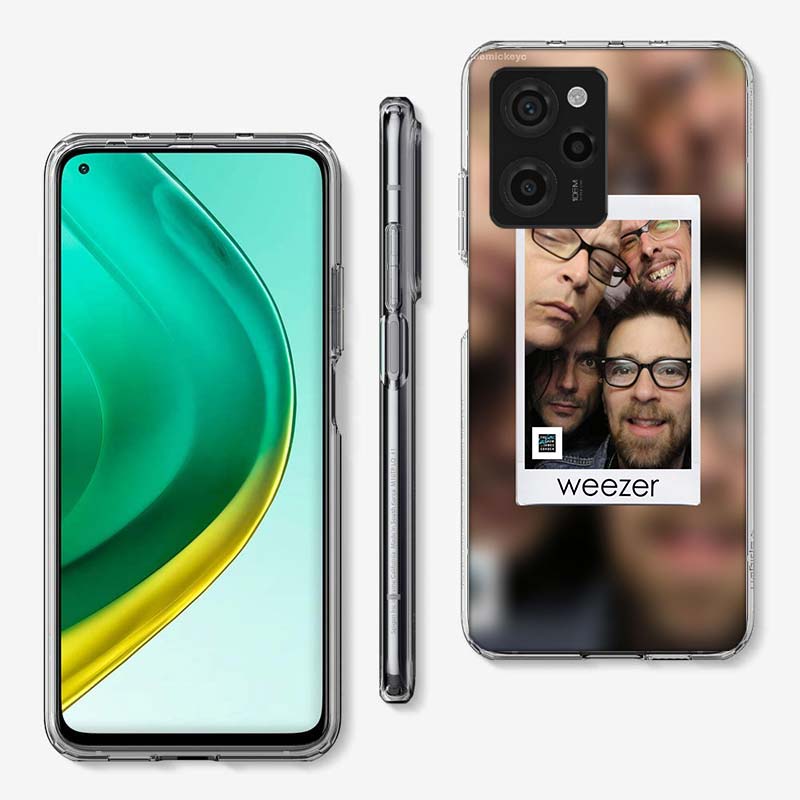 Band W-Weezer Cover Phone Case For Xiaomi Poco M8 M7 M6 M4 M3 X7 X6 X4 Pro F7 Ultra M5S Mi 14 14T 15 15T 12T 10T Pro 12S 12 11 L