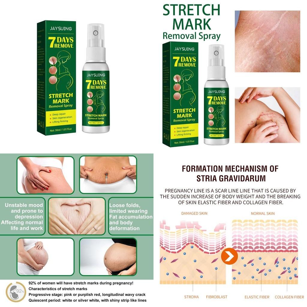 Jaysuing Skin Care Spray For Postpartum Skin Firming And Fine Line Reduction In 30ml Packaging