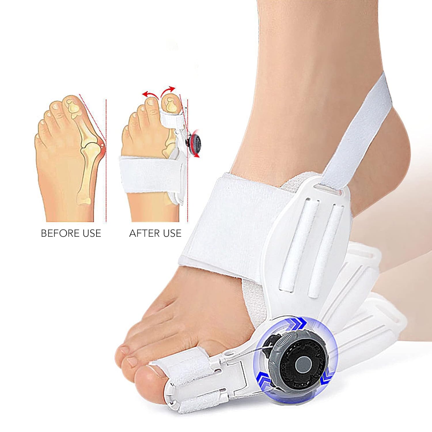 Yosoo Bunion Corrector Bunion Corrector Splint, Hallux Valgus Corrector Big Toe Brace Adjust Degrees Thicken Silicone Prevent Overlapping Thumb