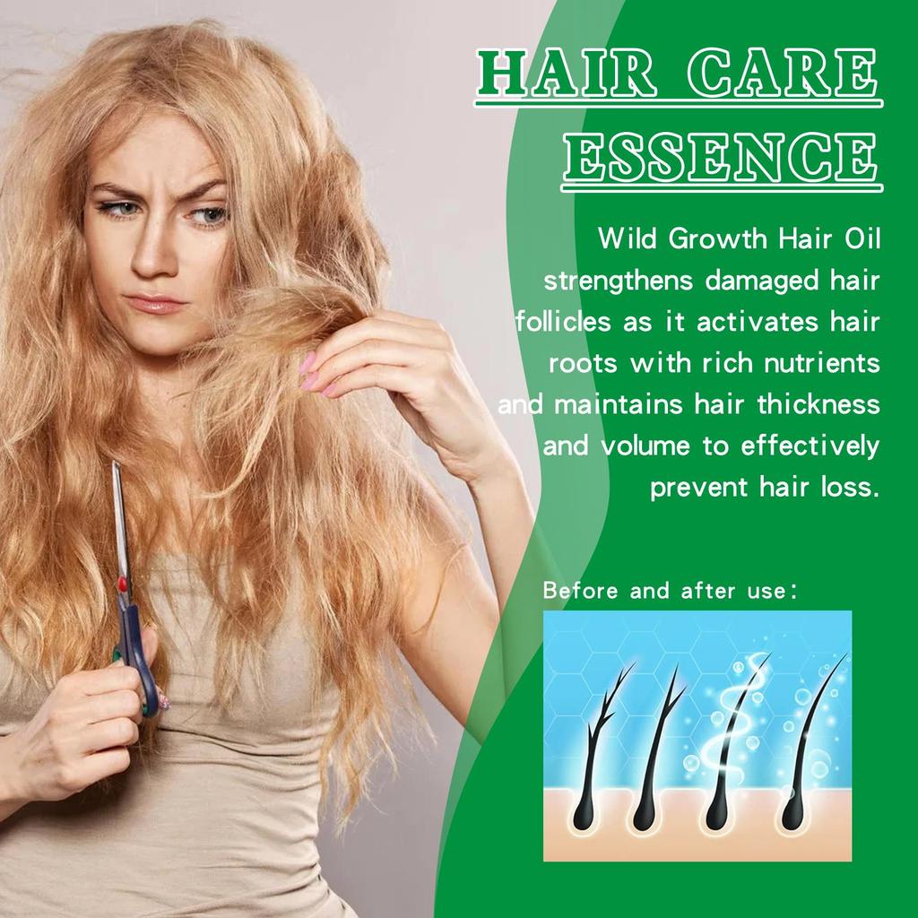 EELHOE Ginger Hair Growth Serum (30ml) - Anti-Hair Loss, Healthy Beauty, Hair Care Oil, Hair Thickening Growth Essence