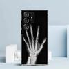 Autumu X Ray Hand Bones Soft Cover for Samsung Galaxy S25 Edge S26 S24 S23 Ultra Phone Case S22 S21 Plus S20 FE Print Pattern Sh