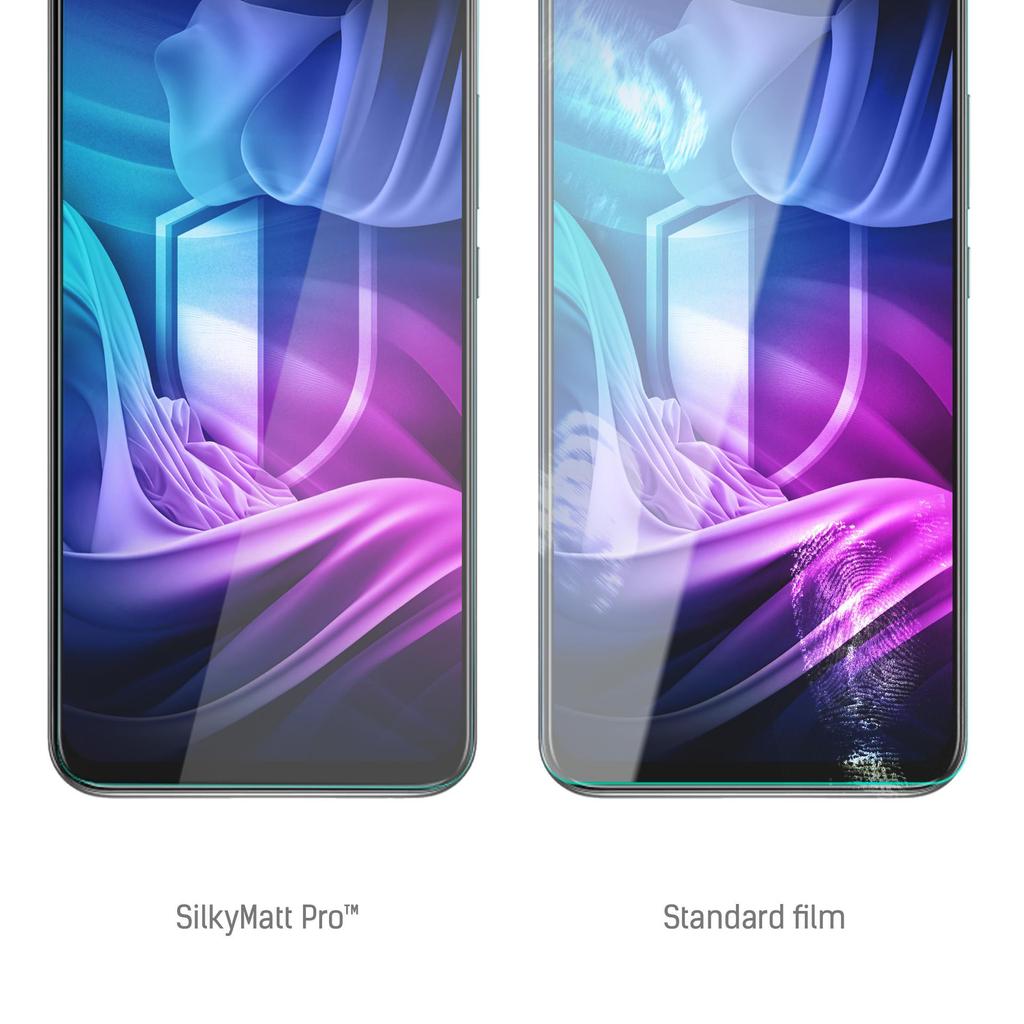 Xiaomi Mi 10 Lite 5G - 3Mk Silky Matt Pro