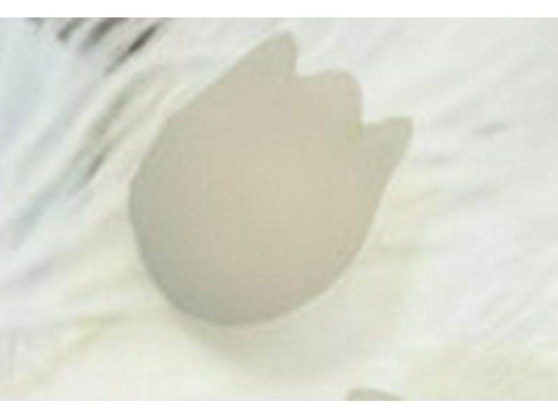 Tulip Silicone Anti-Slip Yarn Stoppers & Needle Caps for Knitting and Crochet