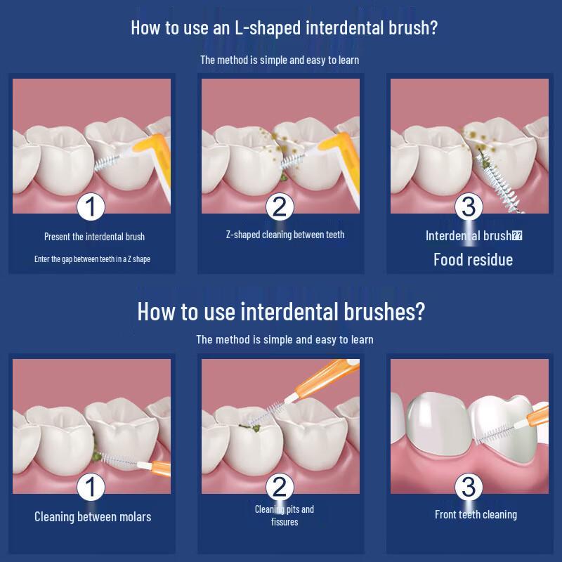 FAWNMUM Orthodontic Interdental Brushes