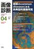 Diagnostic Imaging, April 2024, Vol. 44, No. 5: Atypical Imaging Findings In Common Head Diseases