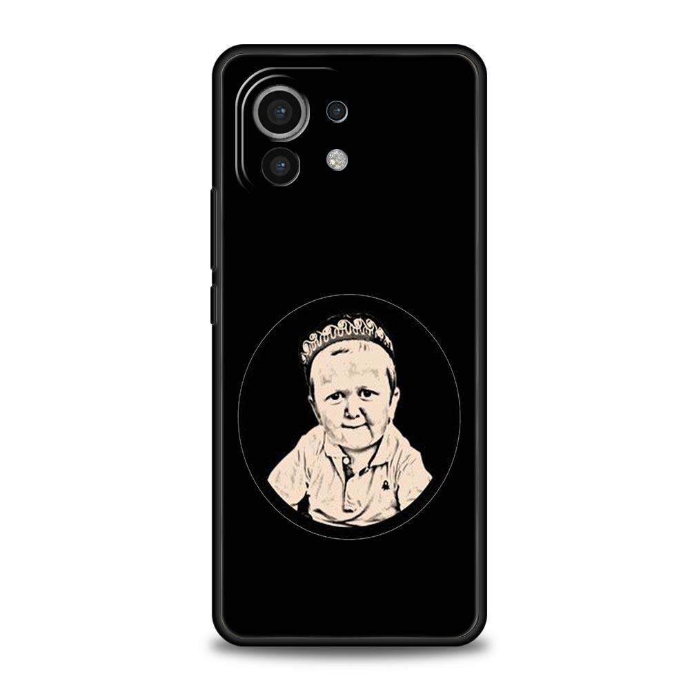 Funny Babaite Hasbulla Phone Case For Xiaomi Mi 17 15T 15 14 14T 13T 12T Pro 12 13 Lite 5G 11T Poco X6 X7 X5 Pro Soft Cover