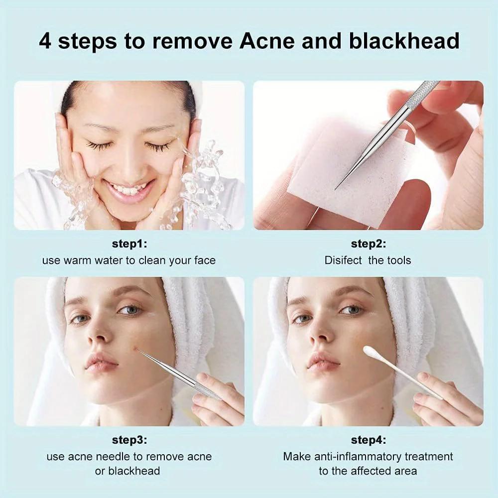 Pimple Extractor Tools,Blackhead Remover,Pimple Popper,Acne Removal Kit Risk Free Treatment,Whitehead Popping,Blackhead Tweezers