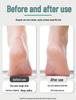 Electric Foot Callus Remover with Digital Display