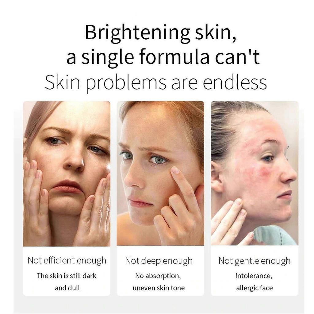 Limited time!!Eelhoe Watermelon Facial Serum Hydrates And Moisturizes, Leaves Skin Smooth And Delicate, Daily Care