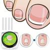 10Pcs Toenail Straightening Clippers Toenail Correction Tools Set Nail Care Elastic Stickers Pedicure Foot Care Tools