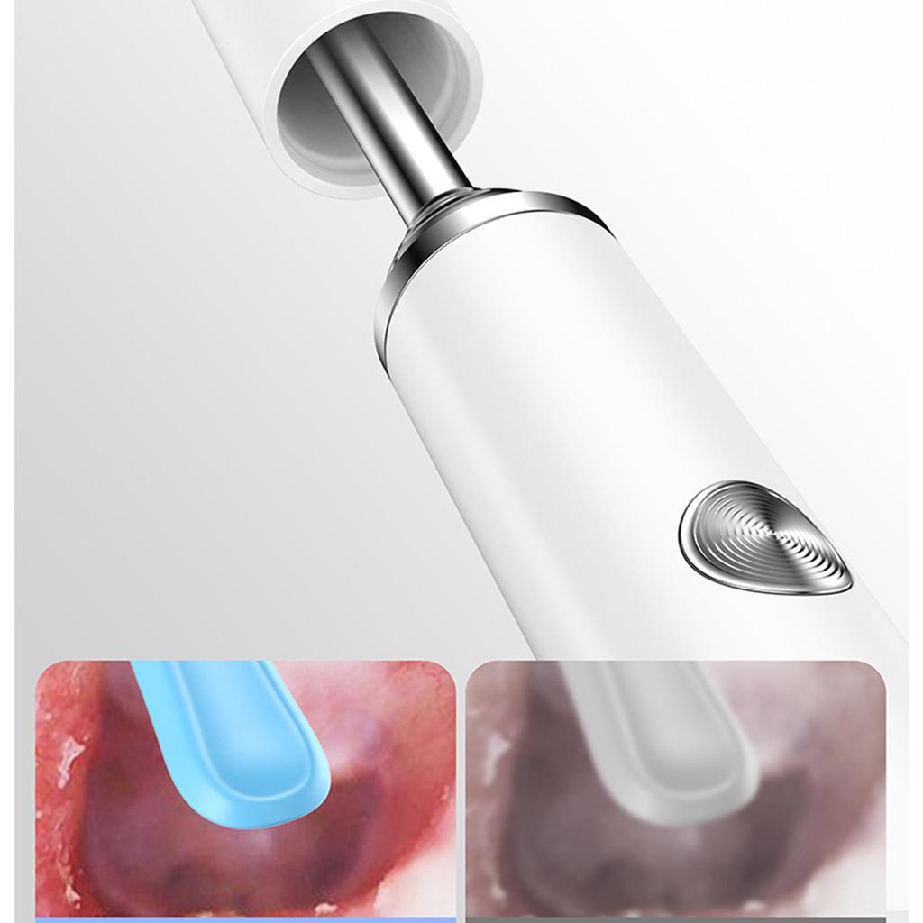 Visual ear pick high-definition endoscope children's ear cleaning tool wireless Bluetooth luminous ear cleaning artifact