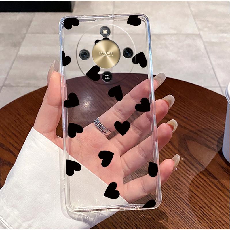 For Honor X9d 2025 Case Clear Luxury Cute Love Rabbit Funny TPU Soft Silicone Phone Case For Honor X9d 5G Transparent Back Cover