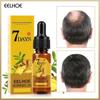 2pcs Hair Growth Essence Natural Beauty Hair Growth Fluid Ginger Hair Growth Essence Oil