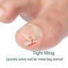 10 sztuk/zestaw wrastający paznokieć Pad elastyczny Ortho wypełnianie paznokci podkładka do rowków wrastający korektor do paznokci drut artefakt narzędzie do pielęgnacji stóp