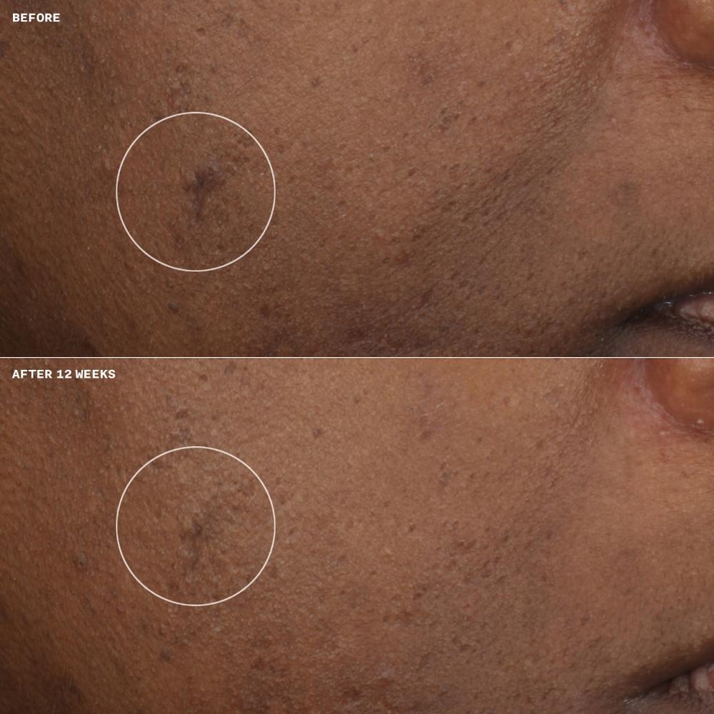 Clinique Even Better Clinical Aufhellende Feuchtigkeitscreme