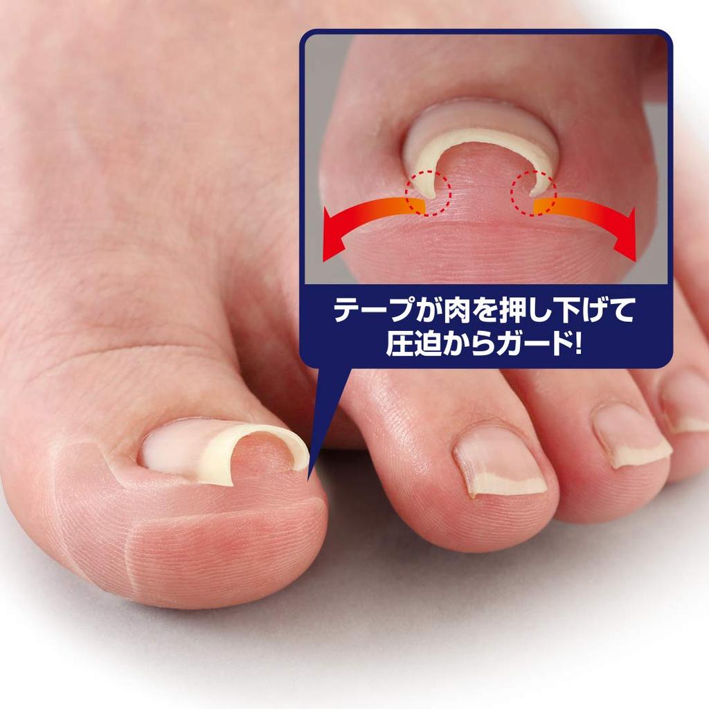 Cyplus Transparent Ingrown Nail 50 Thin Transparent Transparent Double Does Not Enter Claw Guards From Nail Pressure Miene Tape, Pieces, Plate, Film,