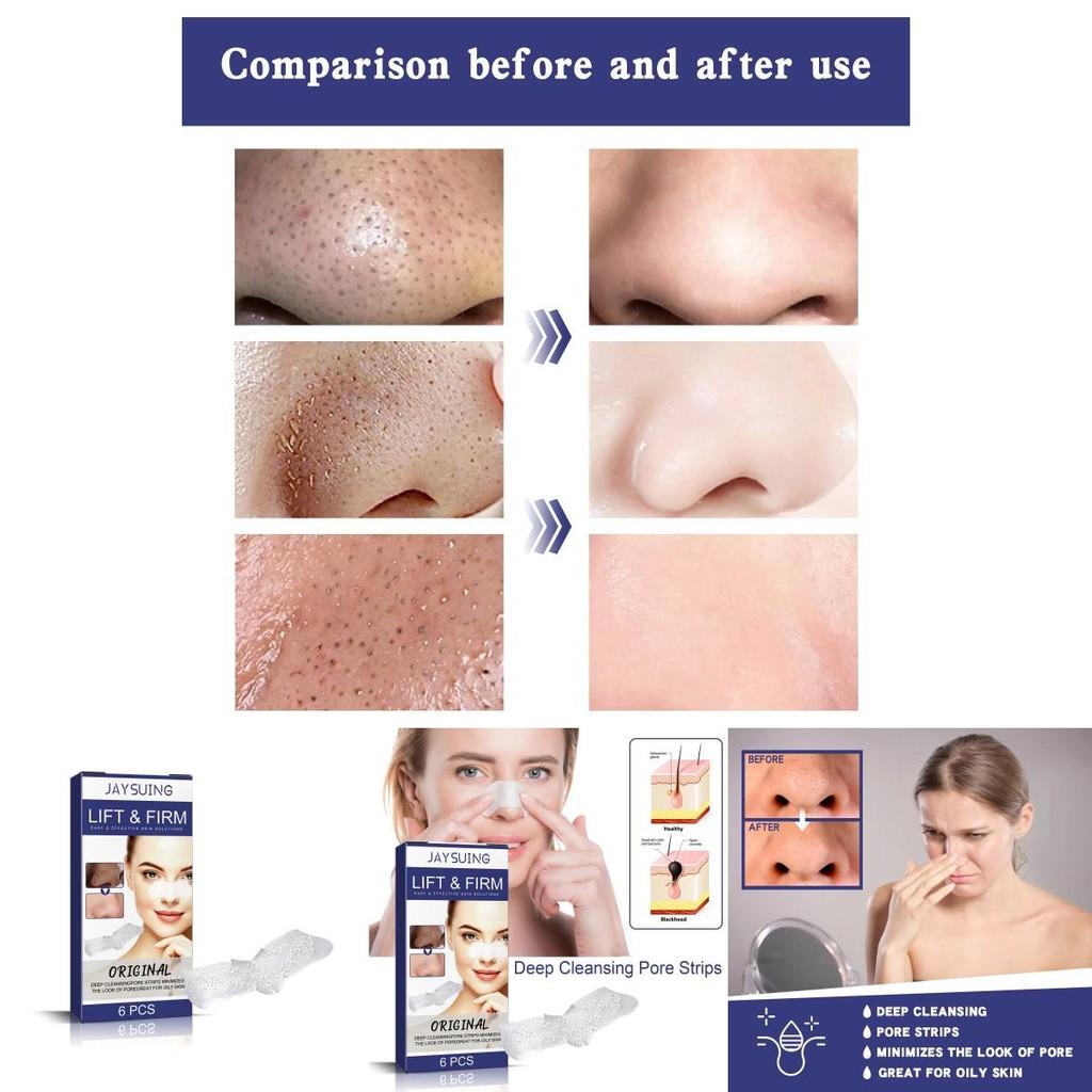 Tiras Limpadoras Profundas Jaysuing Para Remoção de Cravos E Poros Dilatados 6 Unidades