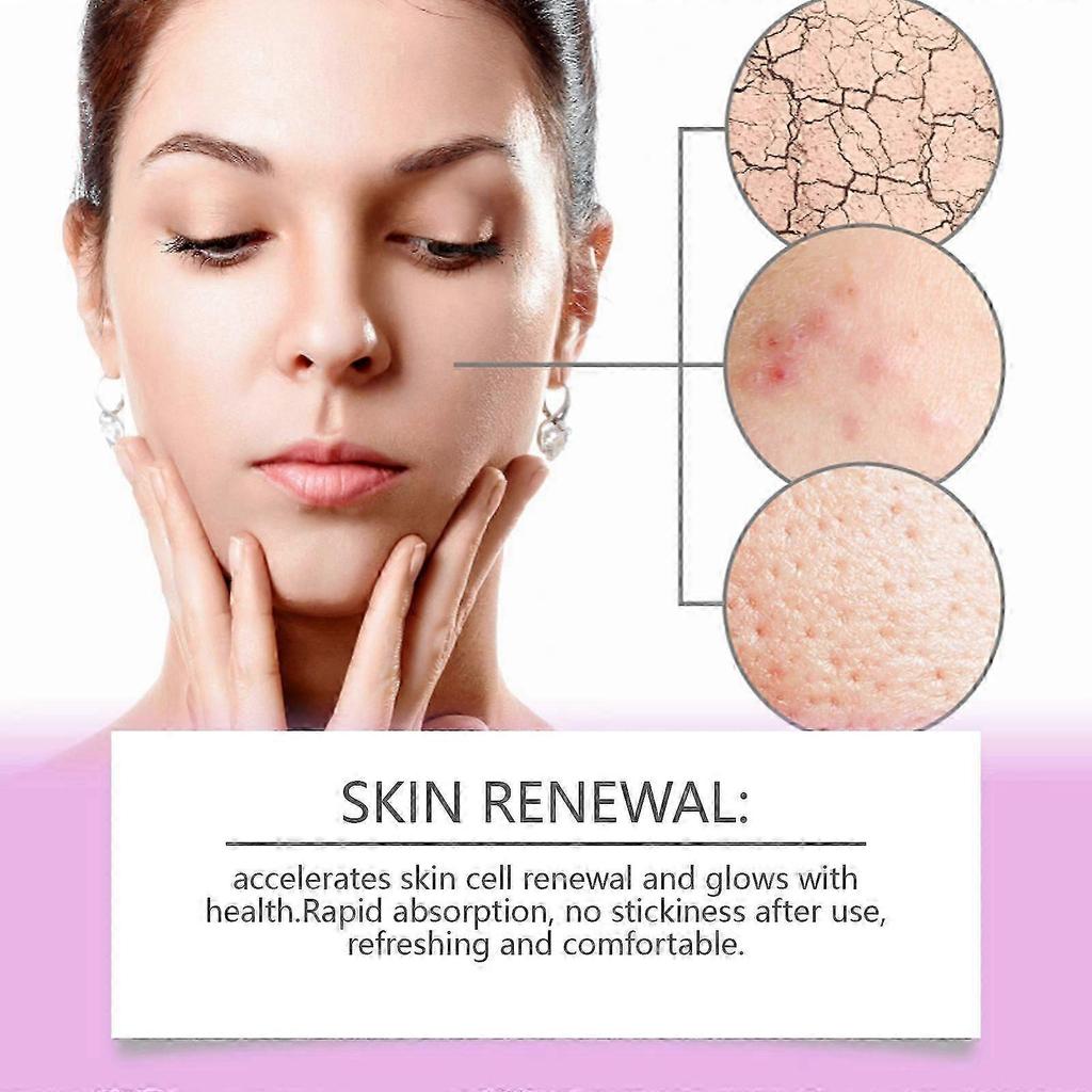 2025 Latest Model  Azelaic Acid Anti-Acne Repair Cream To Reduce Acne And Improve Redness
