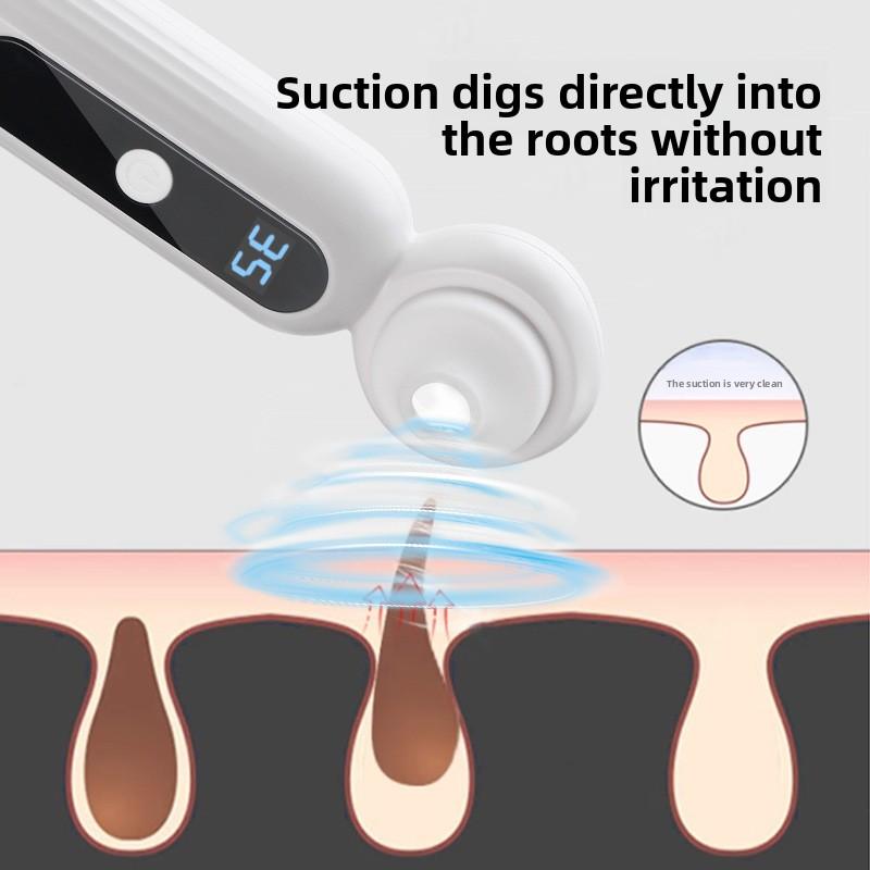 Visuelles Mitesserinstrument, Mitesserabsaugung Porenreinigung Mitesserabsaugungsartefakt Mitesserinstrument Fünf-Gang-Einstellung Schönheitsinstrument