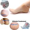 Big Buzz Anti Crack Silicone Gel Heel and Foot Protector Moisturizing Pads for Foot Care, Skin Softening Treatment Socks for Pain Relief & Heel C
