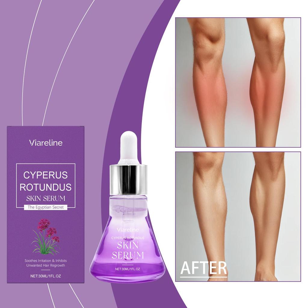 Cyperus Rotundus Skin Serum Hair Growth Inhibitor Natural Soothing Moisturizing Shrinking Pores Body Hair Removal Essence Liquid
