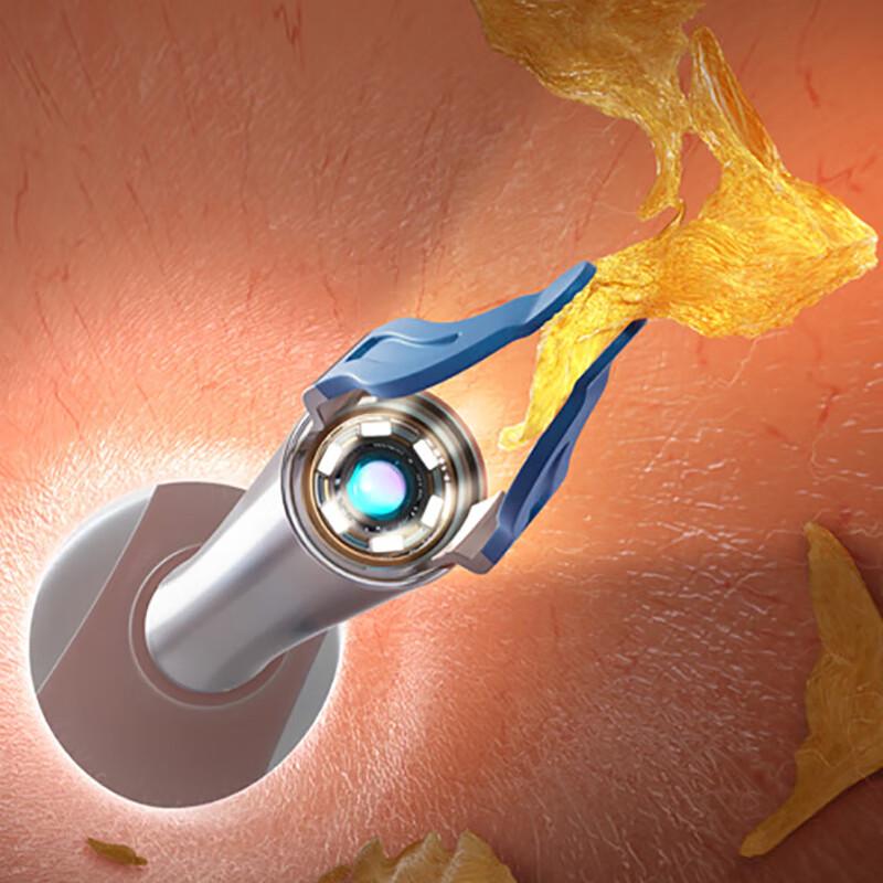 Bebird R37R Smart Visual Ear Cleaner