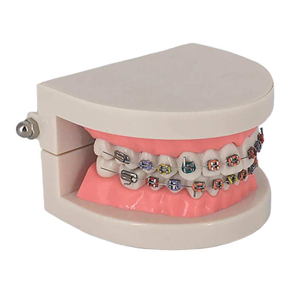 Buy Dental Orthodontic Standard Teeth Tooth Model Metal Brackets ...