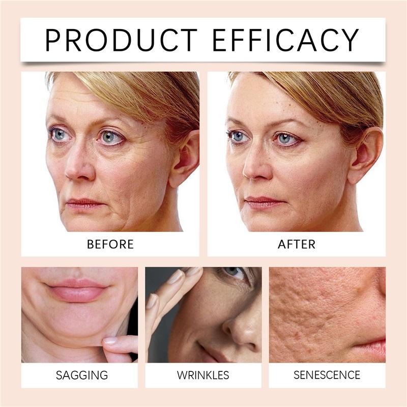 Hoygi Retinol Bijengif Gezichtscapsules Hydrateren Gezichtshuid Zachtjes, Verstrakken en Verbeteren Huidkwaliteit, Hydraterende Capsules