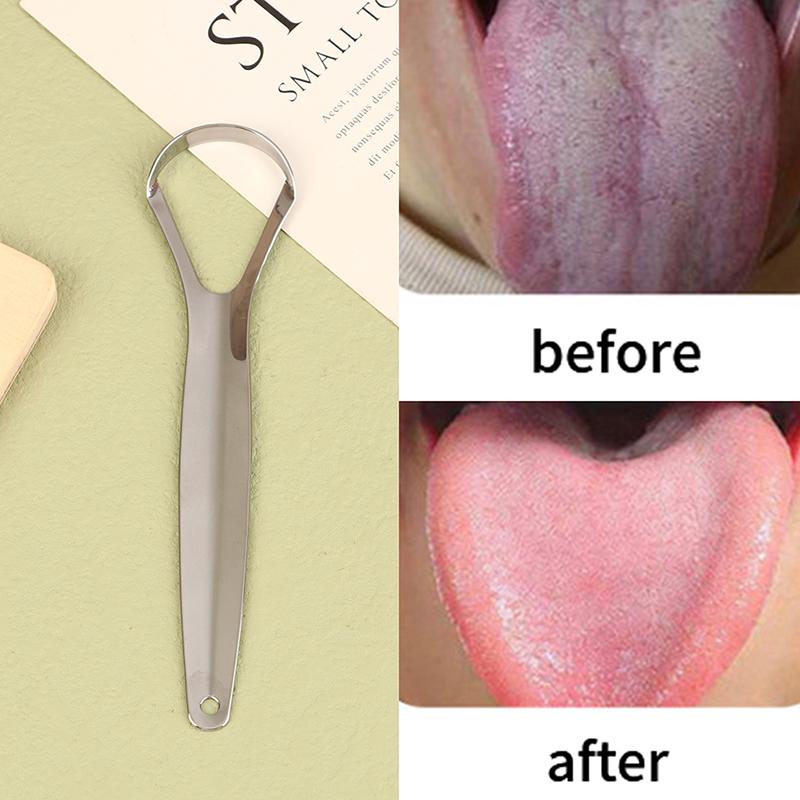 Stainless Steel Tongue Scraper Tongue Metal Cleaner Dental Oral Care Tool