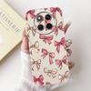 Für Honor X9C Hülle Magic 7 Lite BRP-NX1 Niedliche Kaninchen Cartoon Hülle Weiche TPU Handyhülle Für Honor Magic7 Lite HonorX9C Smart Shell