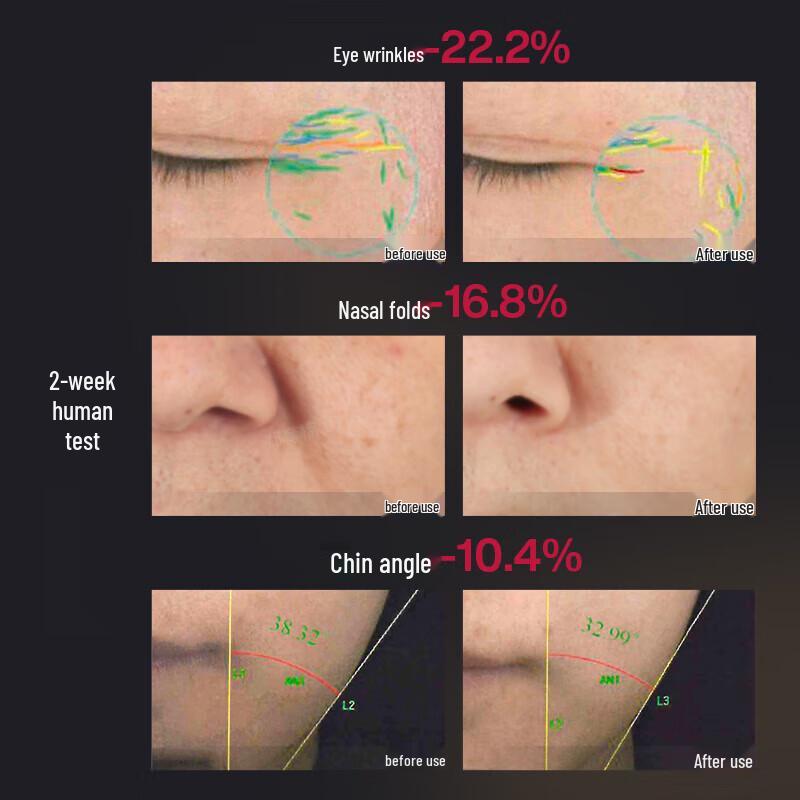 AMIRO R1Pro Facial Beauty Device