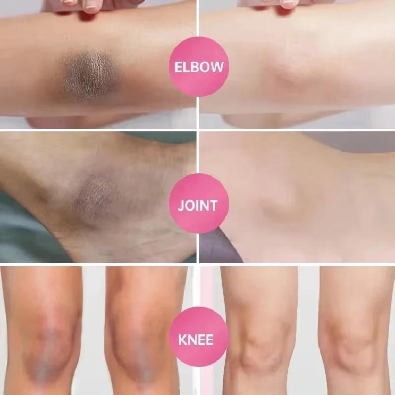 Whitening Cream Private Parts Underarm Bleaching Serum Whiten Butt Knee Brighten Inner Thigh Intimate Parts Dark Remove Melanin