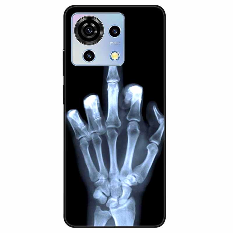 For ZTE Blade V50 Vita Case Phone Cover Shockproof TPU Soft Silicone Fundas for ZTE Blade V50 Vita V50Vita 6.75 Luxury Astronaut