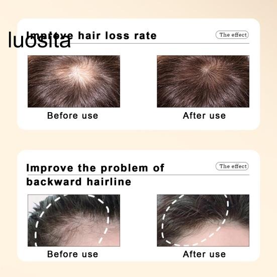 10Pcs 20ML Ginger Shampoo, Anti Hair Loss Gentle Men Women Baldness Treatment Hair Care Natural Ginger Plant Extract Hair Regrowth Shampoo