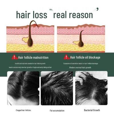 Szampon Daohe Wzmacniający i Stymulujący Wzrost Włosów z Rdestowcem Wielokwiatowym.