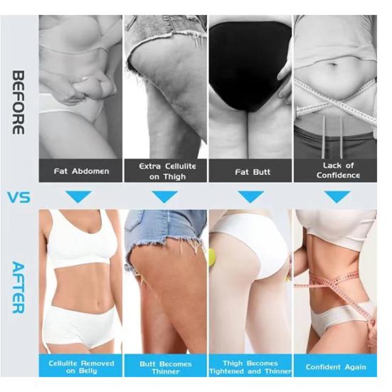 Cellulite Massager Body Sculpting Machine Vibration Frequency Adjustment Portable Electric Handheld Cellulite