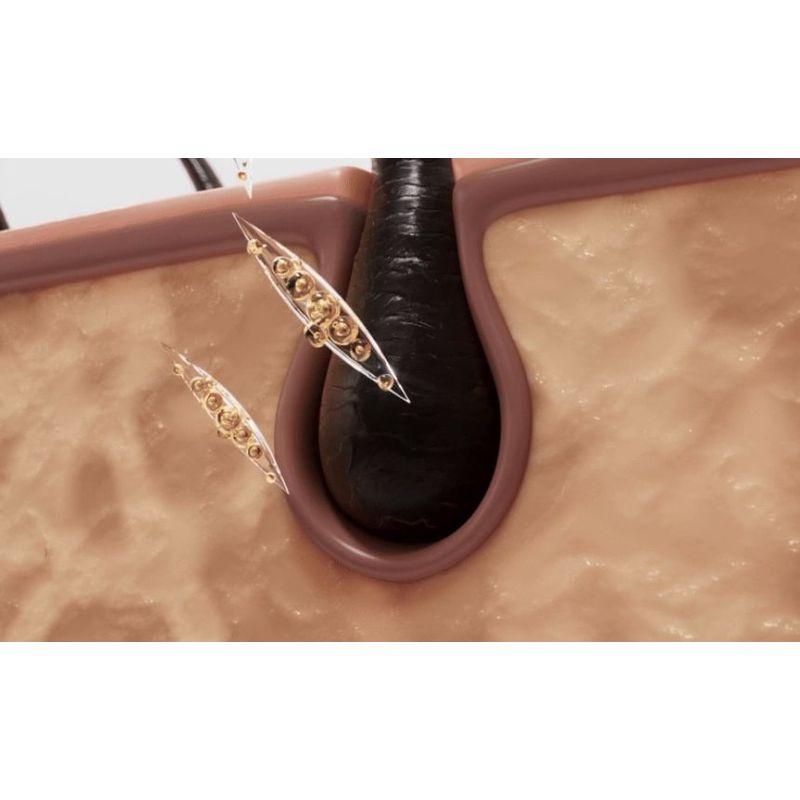 ViveLab - Scalp Spioxyl React Shot 800