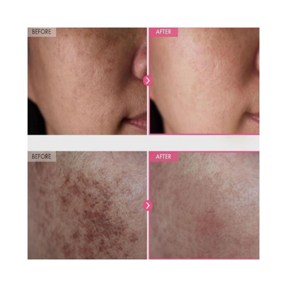 TOSOWOONG Arbutin 7% Tranexamic Acid 4% Cream 50ml Brightening K-Beauty