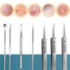11Pcs/Set Acne Needle Blackhead Clip Remover Extraction Pore Black Head Cleaner Face Skin Care Cleansing Needle Tool Cell Clamp