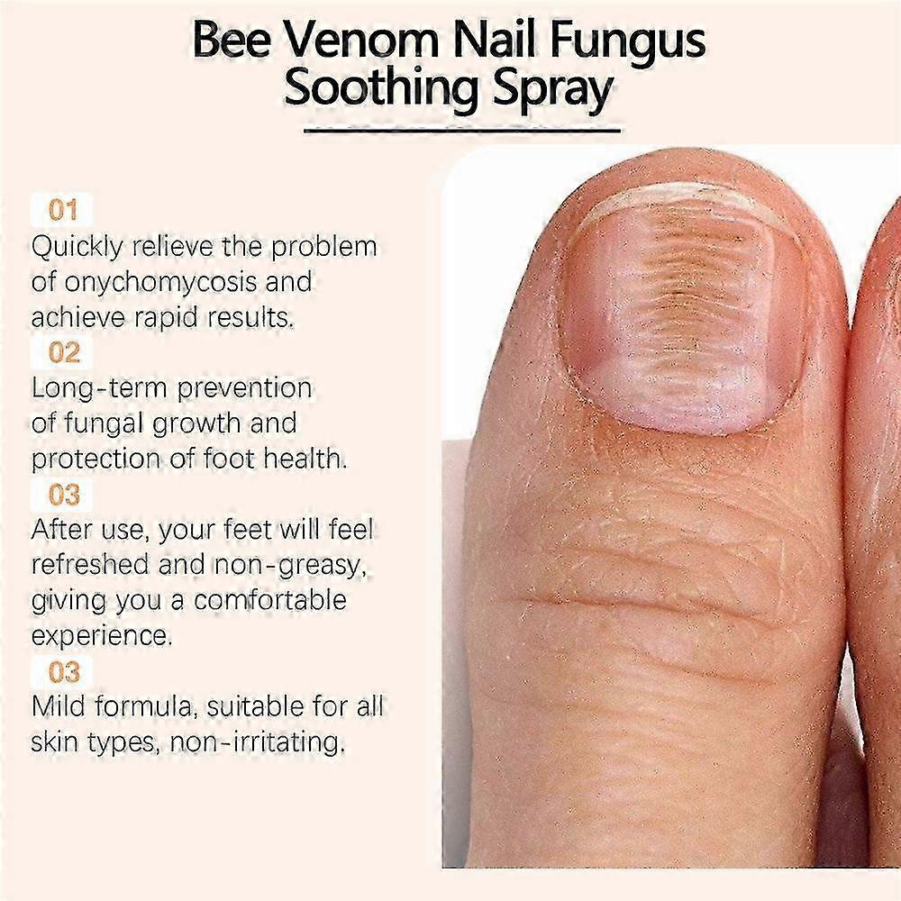Ορός Επισκευής Νυχιών με Δηλητήριο Μέλισσας, Φυσικό Σπρέι Περιποίησης Νυχιών για Εισχωρημένο Νύχι Ποδιού, 1 τεμ.