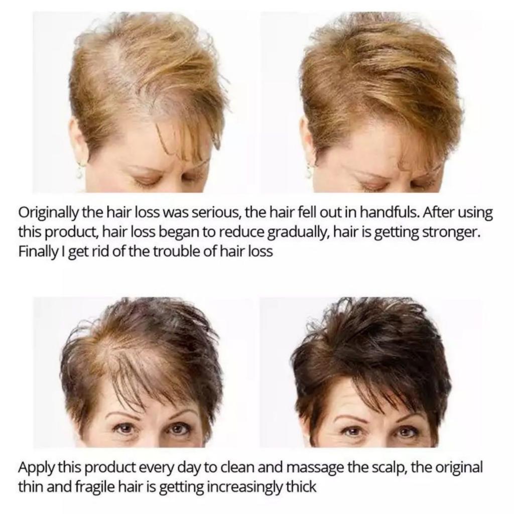 5ML/15ML/30ML/50ML Efficient Hair Care for Men and Women, Anti Damage Dry Repair, Scalp Oil Beauty Care, Prevention of Hair Loss Oil, Scalp Care